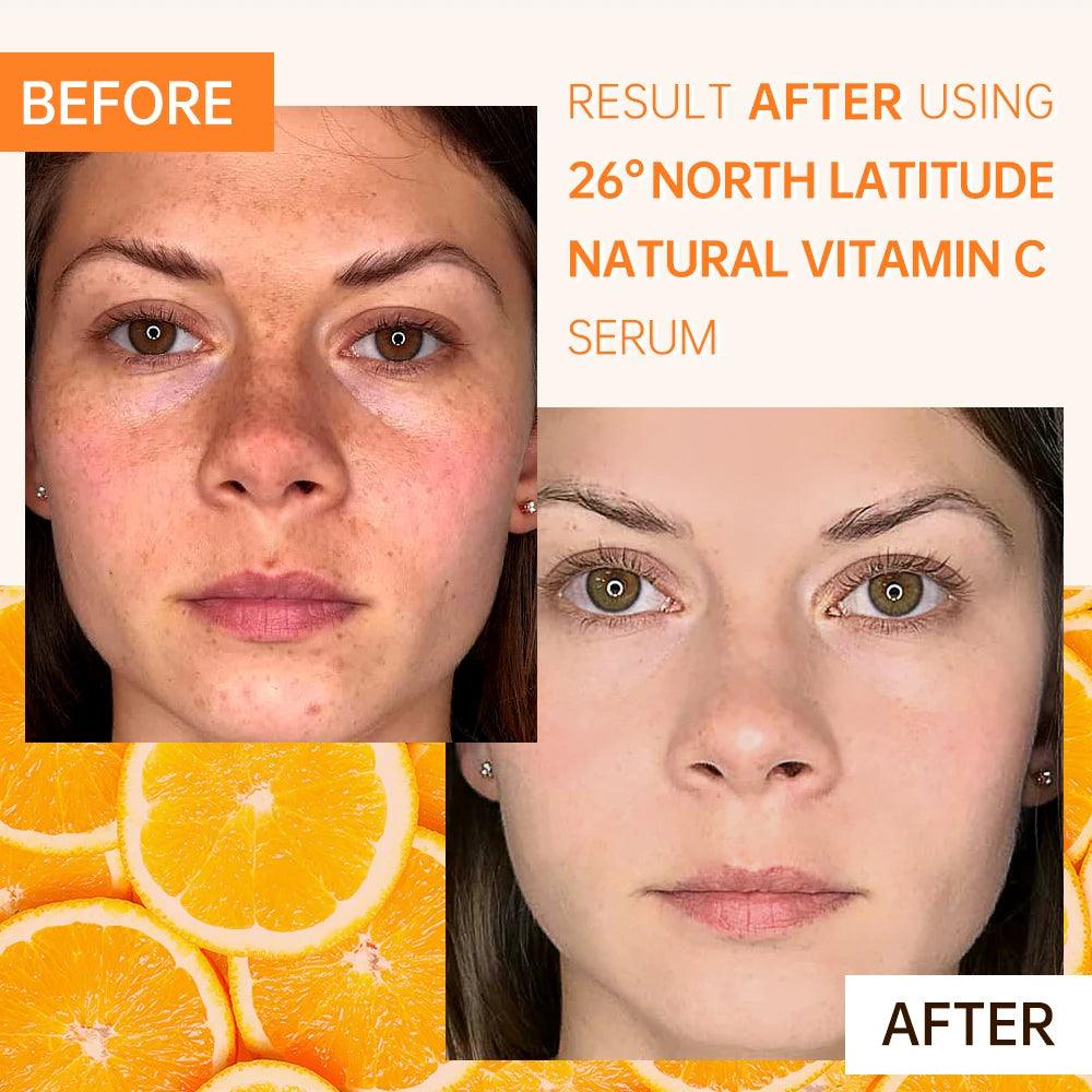 Ensemble skin care à la vitamine C.