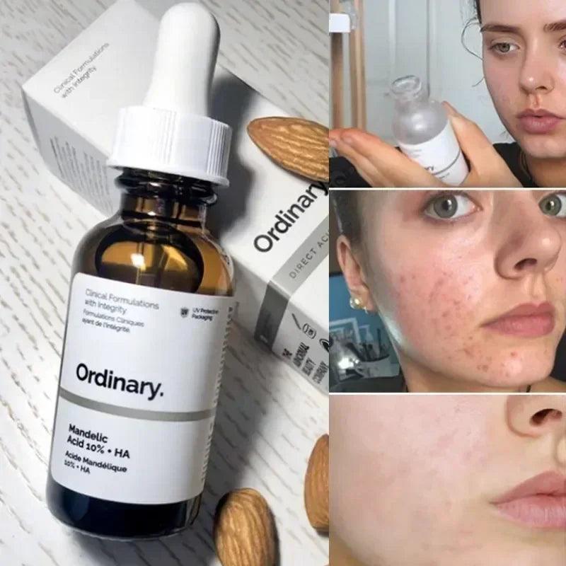 Gamme de Skincare The Ordinary - - The Trendy Boutik